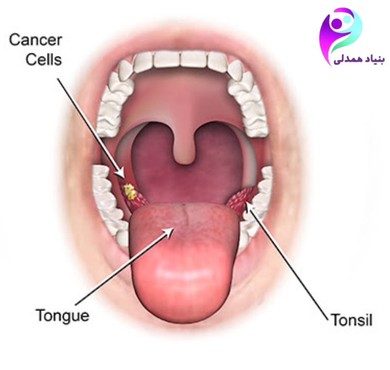 دهان و حلق