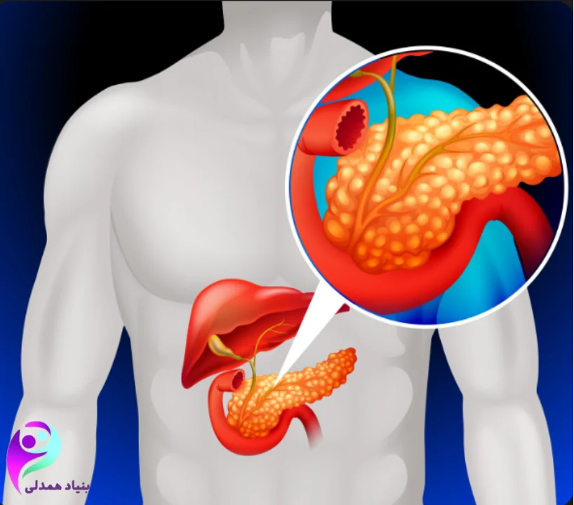 پروتئین مناسب بیماران سرطان روده