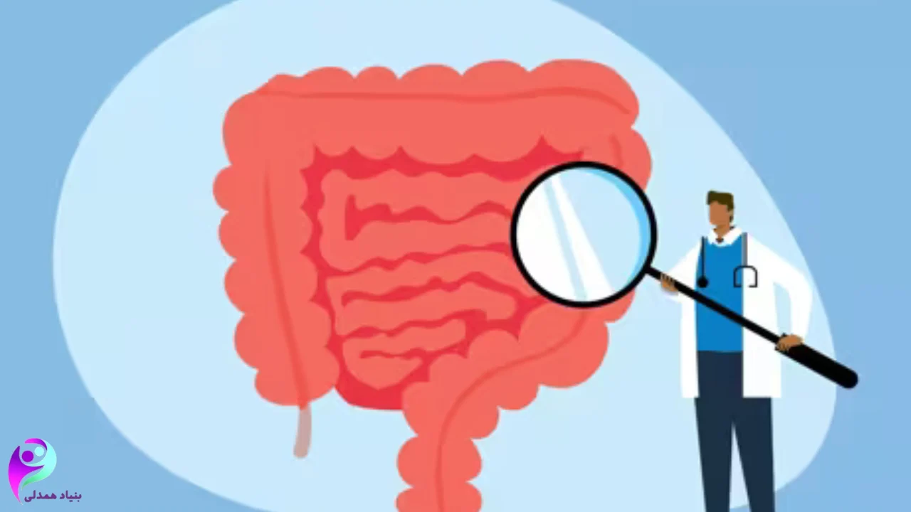 پیشگیری از سرطان روده