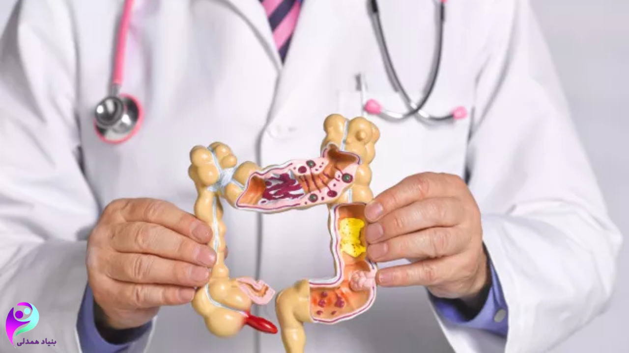 تغذیه بعد از جراحی سرطان روده