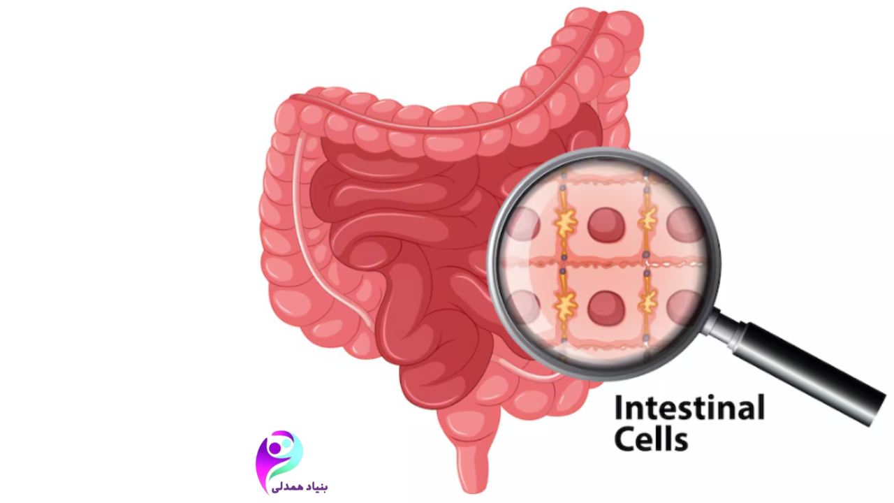 آیا سرطان روده قابل درمان است