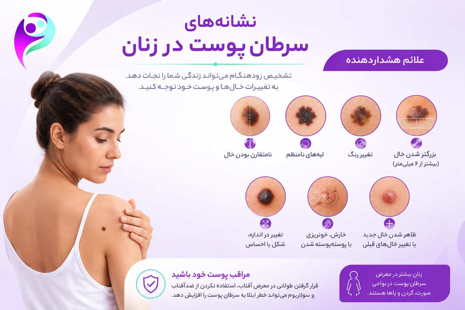 نشانه‌های سرطان پوست در زنان