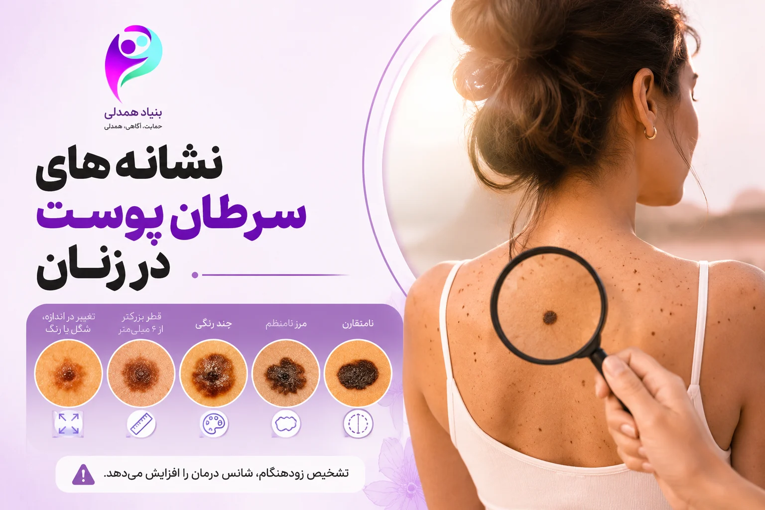 نشانههای سرطان پوست در زنان