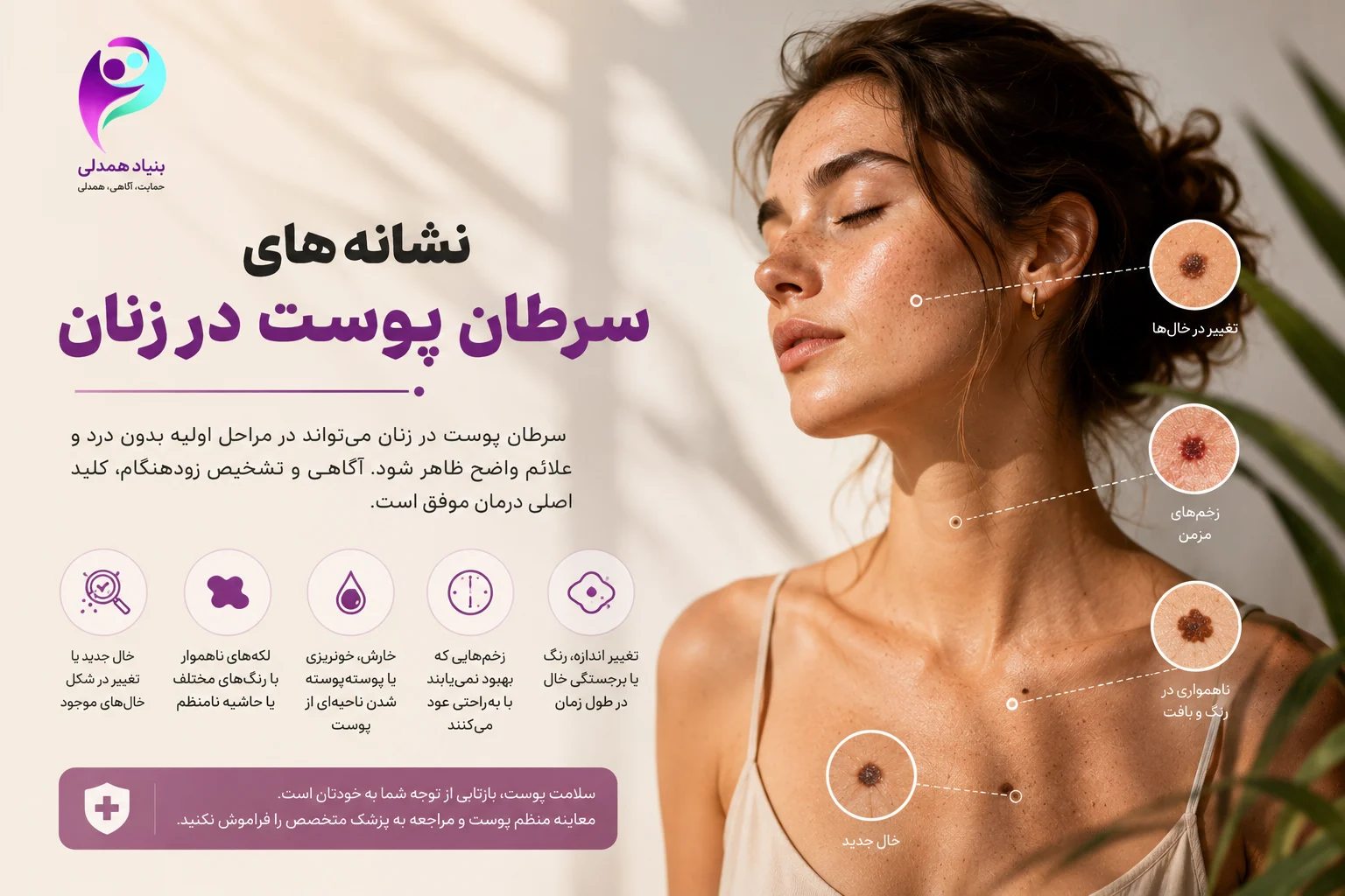 نشانههای سرطان پوست در زنان