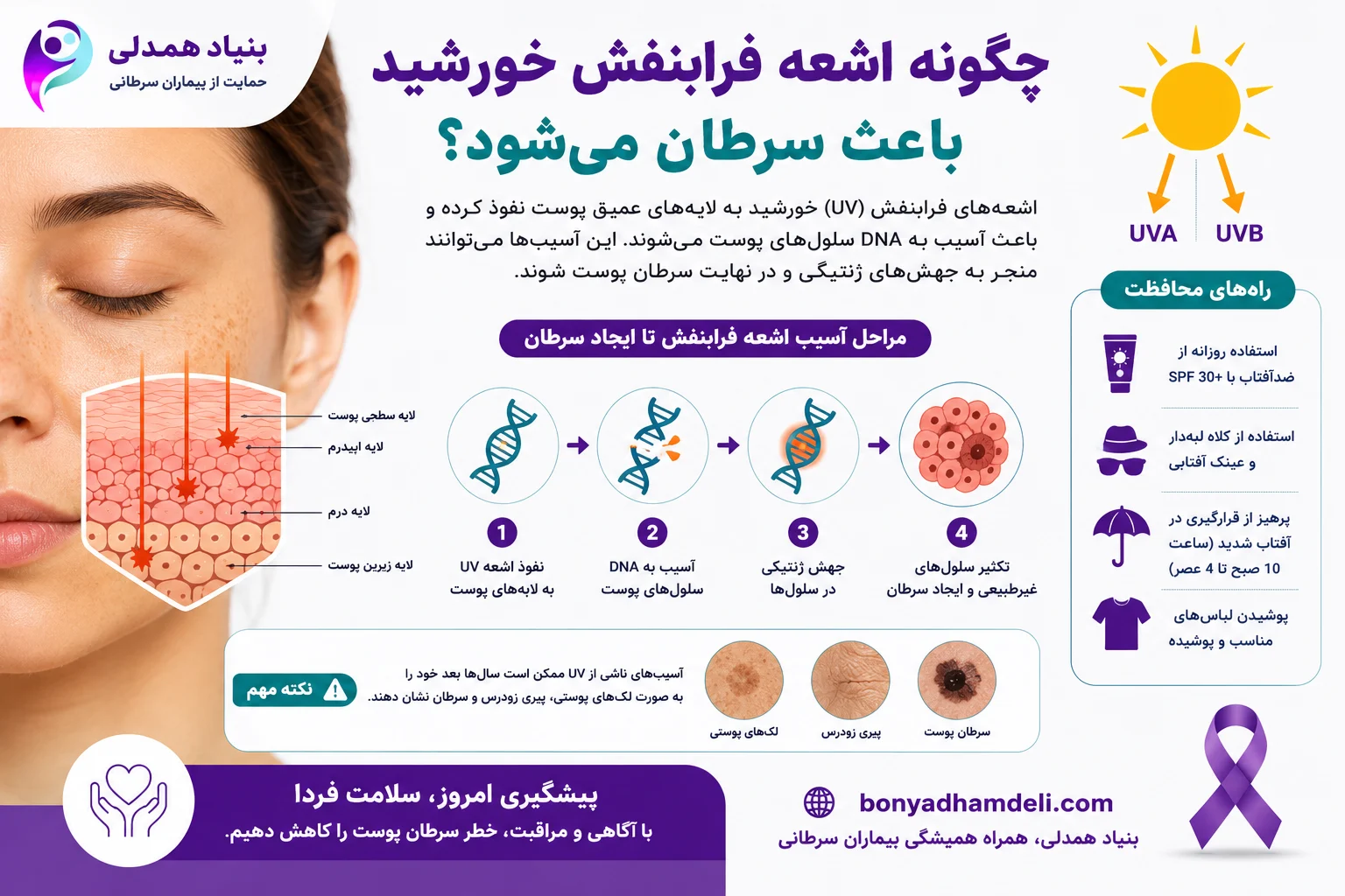 چگونه اشعه فرابنفش خورشید باعث سرطان میشود
