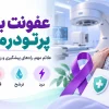 عفونت بعد از پرتو درمانی