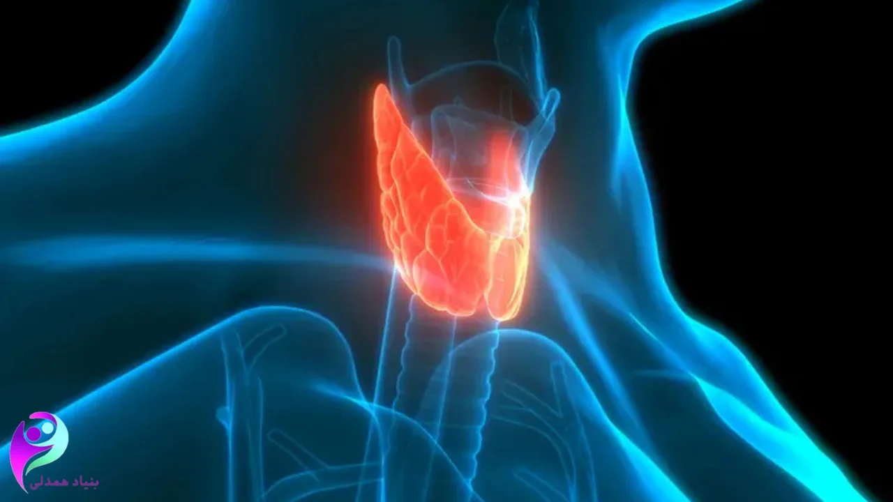 تصویر تیروئید