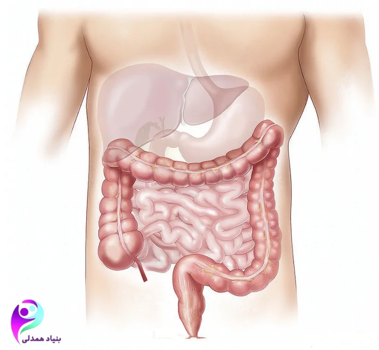 روش‌های تشخیص سرطان کولورکتال