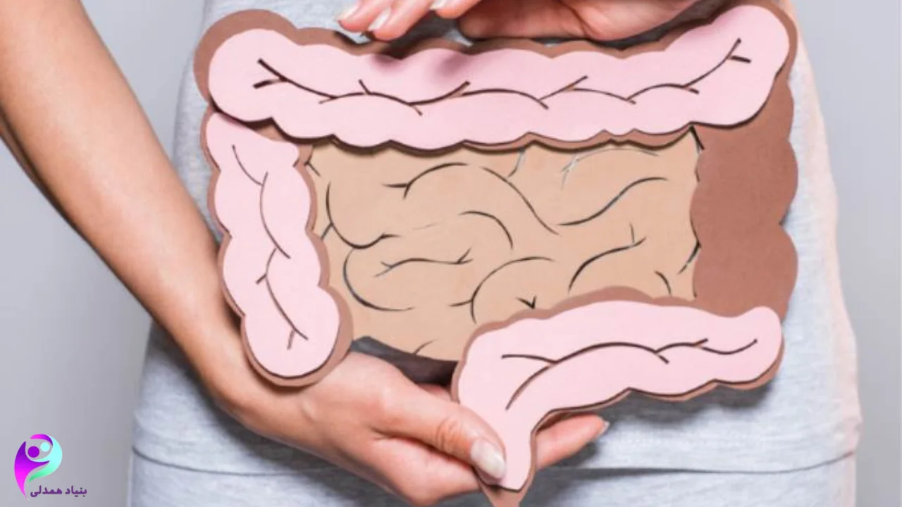 تأثیر ورزش در پیشگیری از سرطان روده